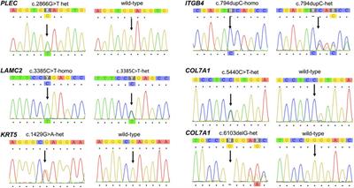 Epidermolysis Bullosa With Congenital Absence of Skin: Congenital Corneal Cloudiness and Esophagogastric Obstruction Including Extended Genotypic Spectrum of PLEC, LAMC2, ITGB4 and COL7A1